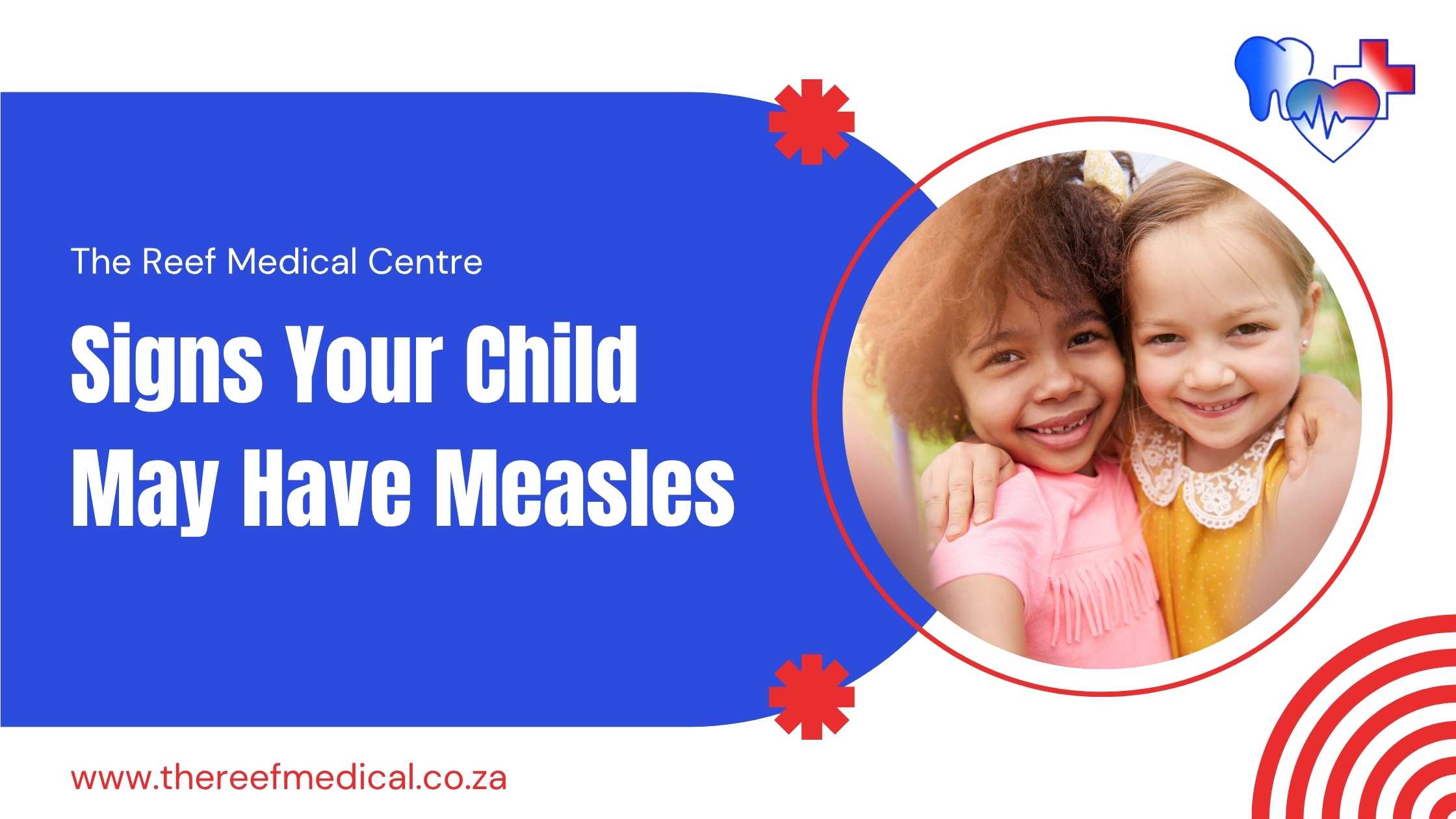 Banner for Signs of measles in children